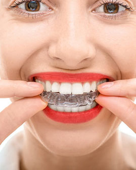 orthodontic retention